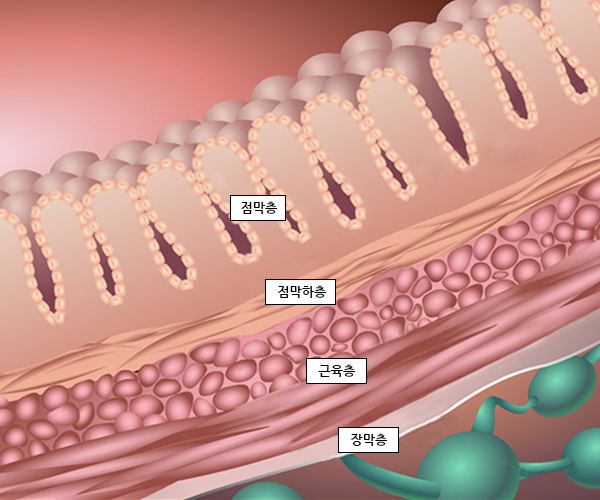 대장 장벽의 구조 사진